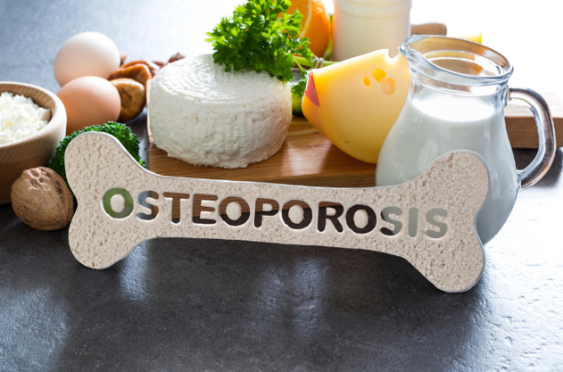 Osteoporosis foods
